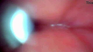 Endoscope Camera Captures Moment of Male Ejaculation with Cum Swapping
