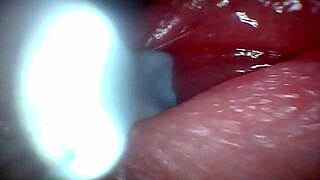 Endoscope Camera Captures Moment of Male Ejaculation with Cum Swapping